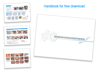 Handbook on intraoral photography